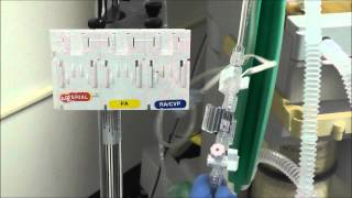 How to Setup an Arterial Line Transducer