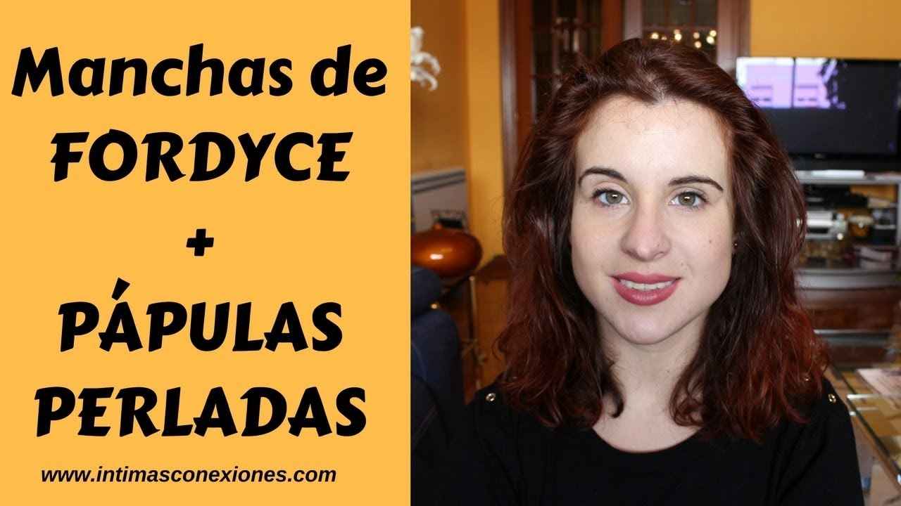 manchas de fordyce en el prepucio interno