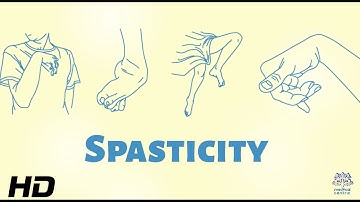 Spasticity: The Hidden Challenge for Individuals with Disabilities