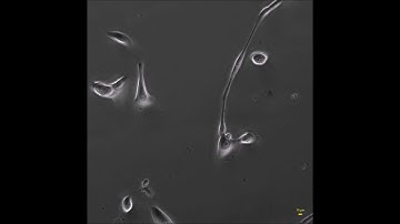 Overnight Cell Movement Under Phase Contrast