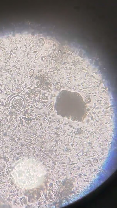 Ova of Hymenolepis nana (H.nana)