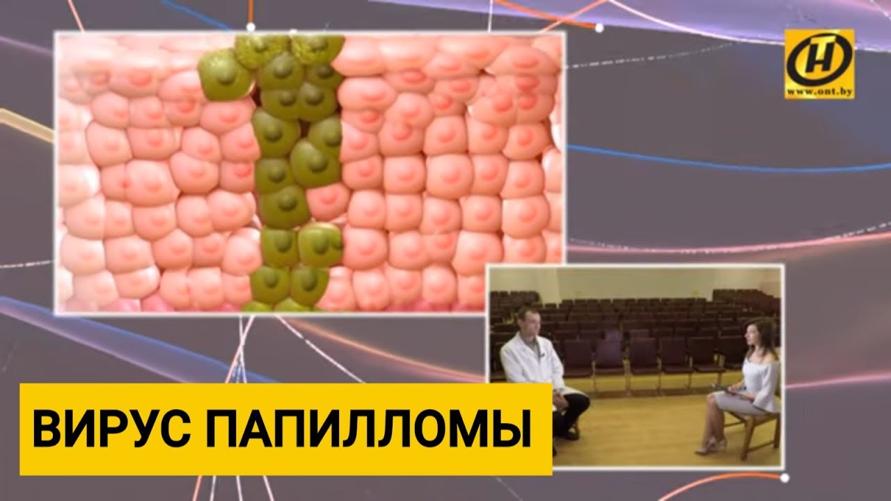 Профилактика вируса папилломы человека, как лечить?