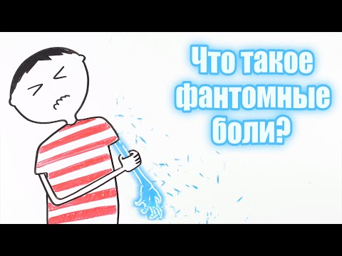 Что такое фантомные боли?