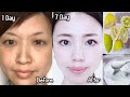 Japanese secret to whitening skin 10 degrees eliminates pigmentation to get a white complexion 100