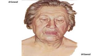 Endocrine: Lecture 18 - Practical Revision