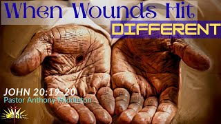 When Wounds Hit Different! Pastor Anthony Middleton