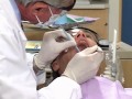 Crowns Gold Crowns Procedure Crowns Gold Crowns Procedure