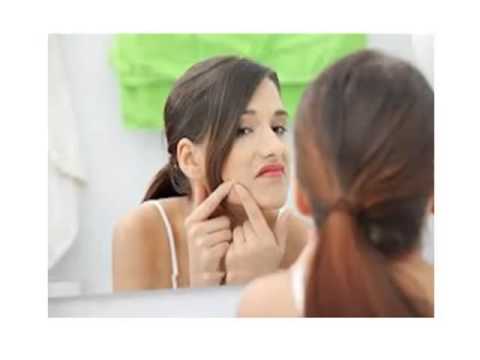 Acne Natural Home Remedies: Acne Home Remedies For Body Acne Treatment