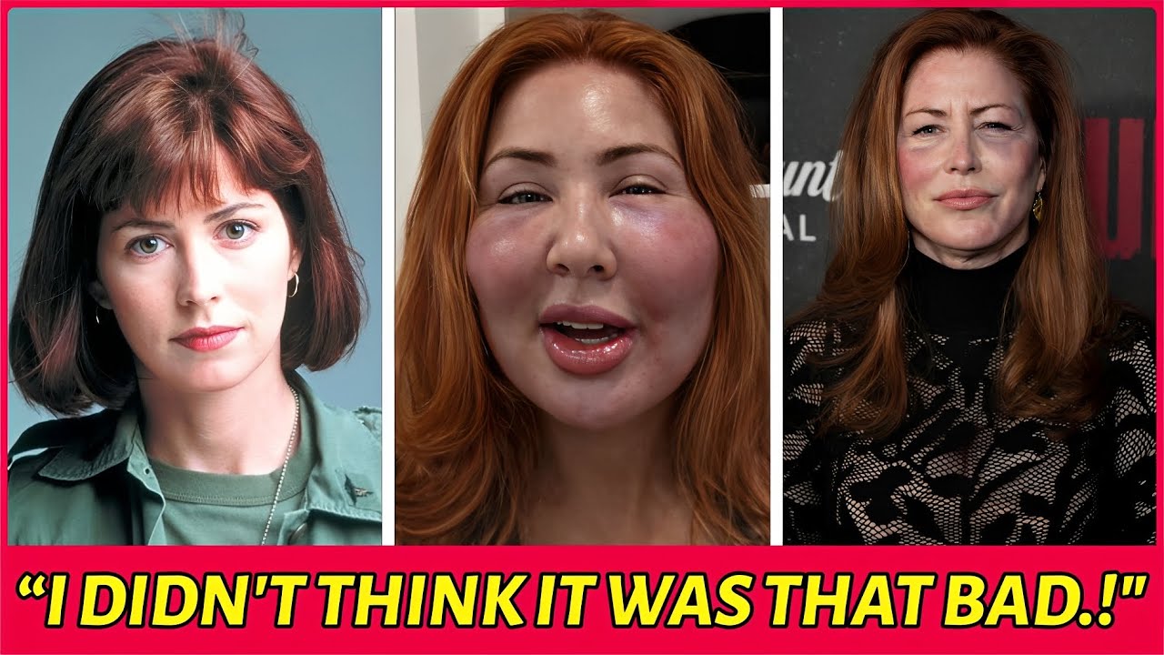 22 Hollywood Celebrities Who Ruined Their Careers With Plastic Surgery