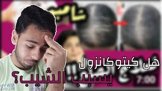 تعليقي علي فيديو دكتور فرح ,شامبو الصلع يسبب الشيب المبكر؟