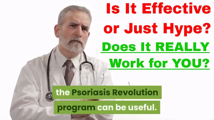 Psoriasis Revolution Program Review: How to treat psoriasis naturally at home