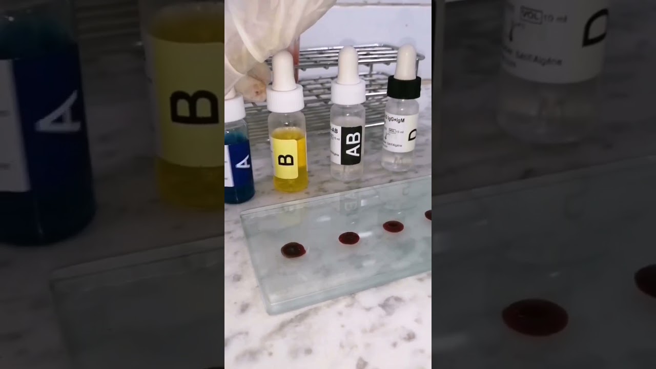 Test de groupage sanguin 💉🩸🤔