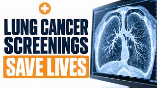 Lung Cancer Screening Saves Lives | Early Detection with Dr. Jacques Fontaine
