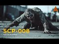 SCP 008 — «Чума зомби» | Zombie Plague | Озвучка SCP