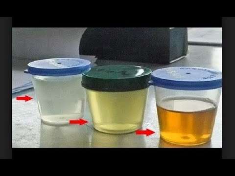 Video: Sidik ketonlarının miqdarını təyin etmək üçün hansı üsullardan istifadə olunur?