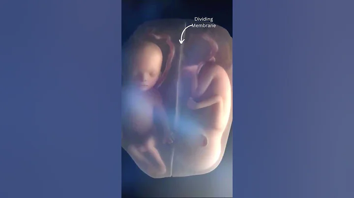 Twins Fighting in Mother's Womb #shorts - DayDayNews