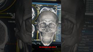 Nee kattakada evide ollee😂😂 in radiology theme😂