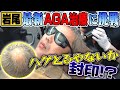 トレードマーク封印!?岩尾が最新AGA治療に挑戦