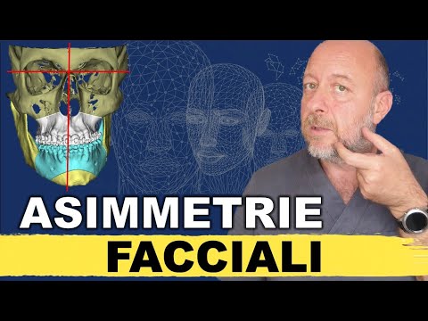 Video: Come correggere l'asimmetria?