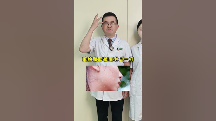 汗从哪里出 病从哪里来 3个方法对症调 #出汗 #乏力 #脾胃湿热 #健康科普 #抖出健康知识宝藏