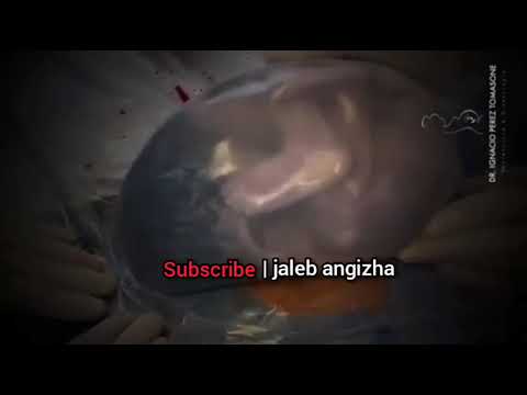 لحظه شگفت انگیز تولد نوزاد انسان