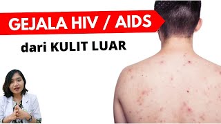 9 Gejala HIV AIDS dari KULIT LUAR | dr.Emasuperr screenshot 2