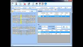 Dentsmile Tutorial screenshot 4