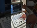 Function 7, N5 power Doppler Ultrasound machine Pakistan Call 03214447817 By Sonotech