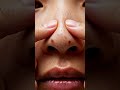 Extreme Nose Blackhead Removal ASMR | Satisfying Pore Cleaning #satisfying #skincare #asmr