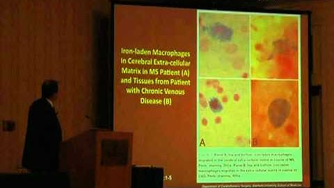 Dr. Dake Lecture Part 2 - Hubbard Foundation 2011 CCSVI Conference