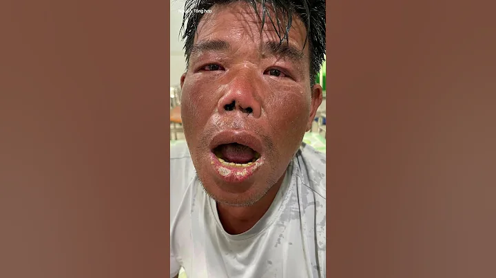 Người đàn ông rơi xuống biển, bơi suốt 4 ngày 4 đêm được cứu sống một cách kỳ diệu