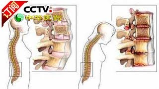 [Chinese Medicine] 20170828 | CCTV-4