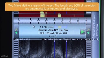 Scan Region Creation and Selection on the TVC Imaging System