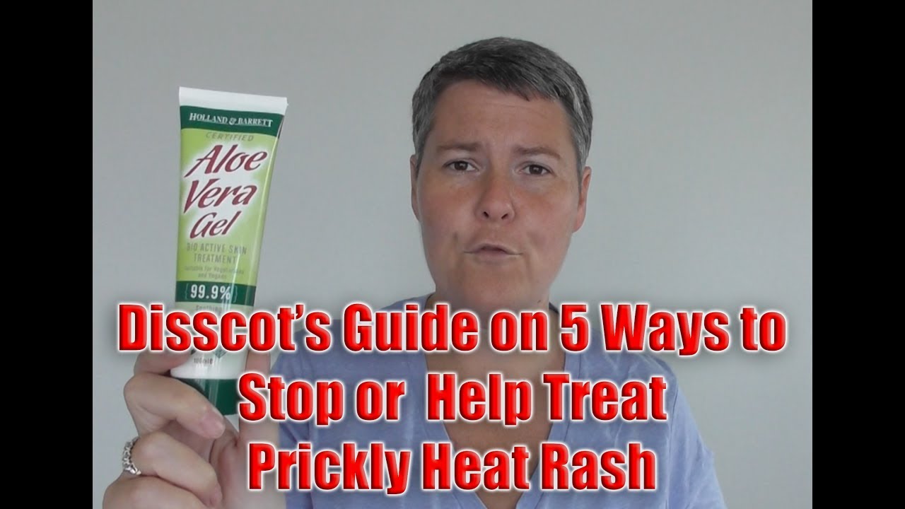 5 Ways to Stop or Help Treat Prickly Heat Rash 