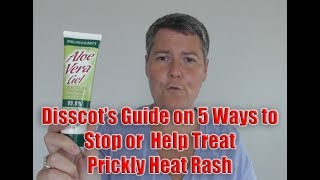 5 Ways to Stop or Help Treat Prickly Heat Rash