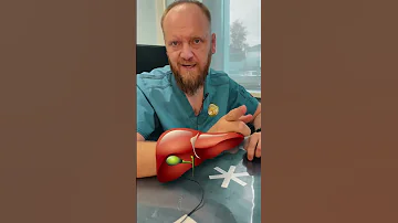 НЕДОСТАТОК ВИТАМИНА Е ПРИЗНАКИ И СИМПТОМЫ #витамине