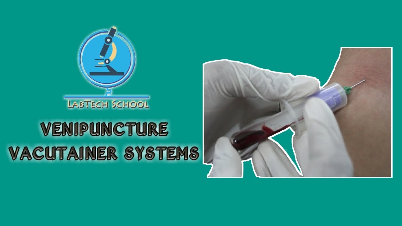 Teknik Pengambilan Darah Vena (Venipuncture) Vacutainer Systems YouTube