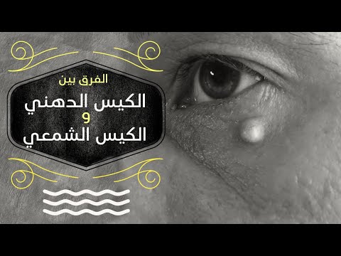 فيديو: أي كيس به نقط؟