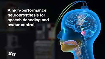 A Neuroprosthesis for Speech Decoding and Avatar Control | Chang Lab - UCSF