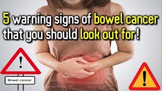 5 warning signs of bowel cancer that you should look out for by Medical.Animation.Videos.Library 1,481 views 5 years ago 1 minute, 46 seconds