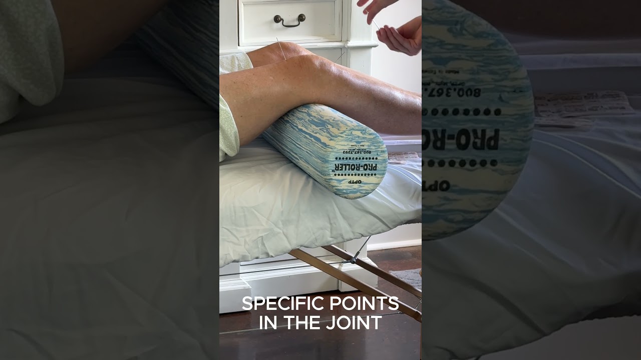 Dry Needling for Knee Pain