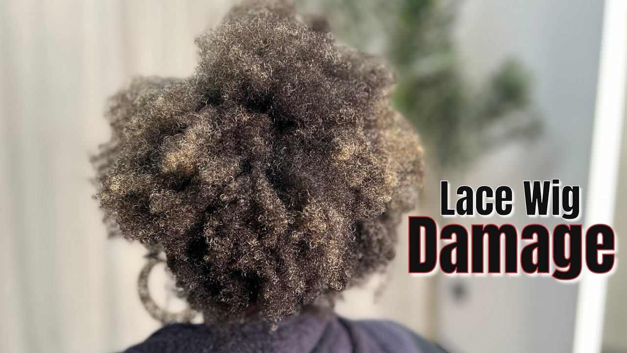 Она потеряла свои волосы из-за париков с кружевной основой… Посмотрите на преображение.