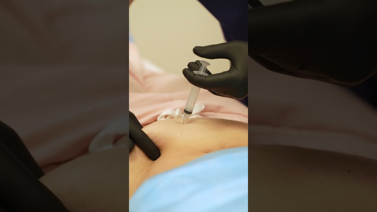 Инъекции против целлюлита: что нужно знать? (читайте описание)