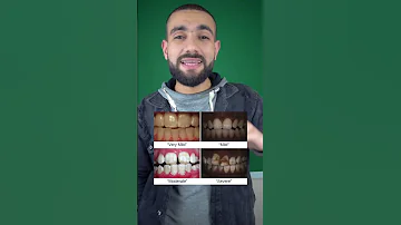 احذر معجون الاسنان اوعي تعمل كدا 