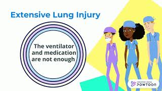ECMO at UHN during Covid-19