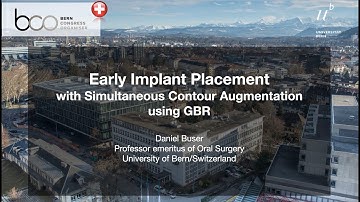 Early Implant Placement with simultaneous Contour Augmentation using GBR – An Animation Video