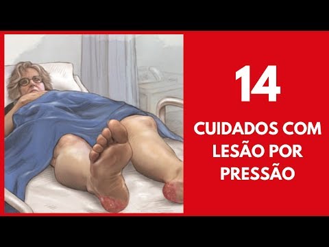 hqdefault - Cuidados com Lesão por Pressão