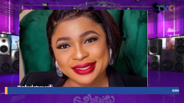 Kemi Afolabi Has Five Years To Live On Lupus Ailments