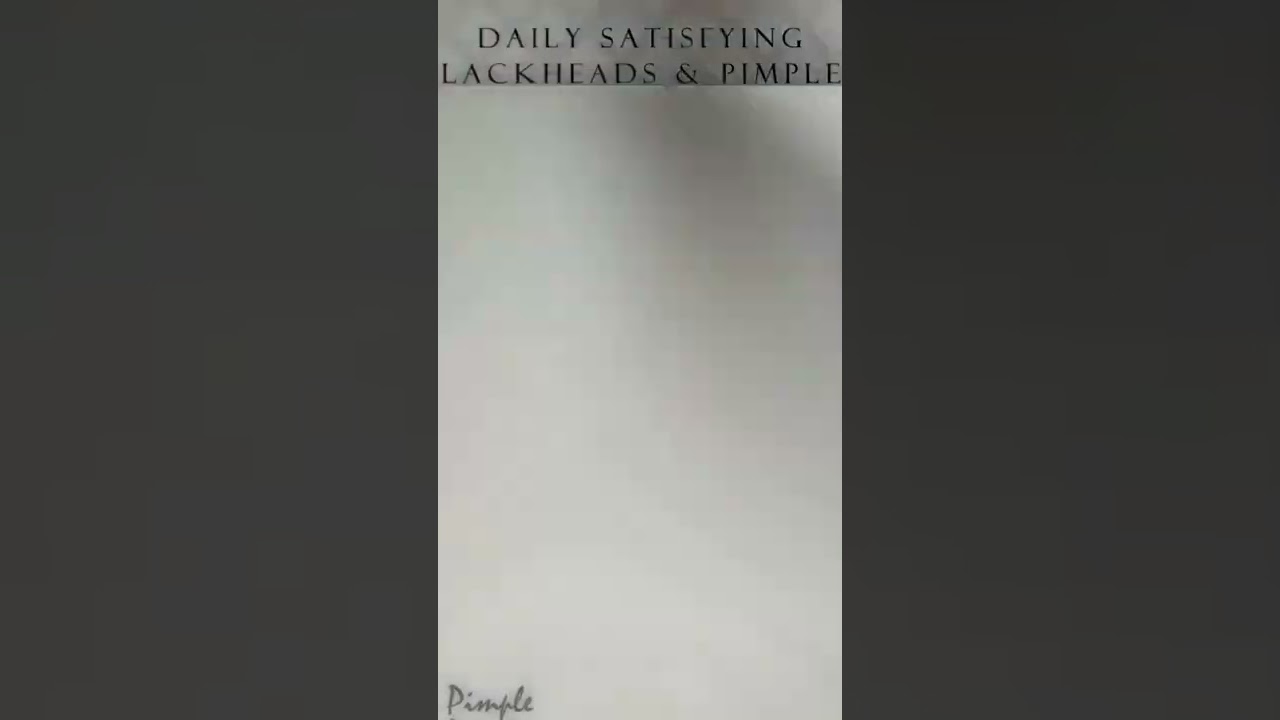 БОЛЬШОЙ ЖИРОВИК🌋И ЧЕРНЫЕ ТОЧКИ НАД ГУБОЙ😻 - YouTube