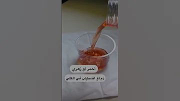 علاقة لون البول بصحتك تأثير لون البول على صحتك البول الاخراج صحتك حياتك الكلى الكبد اكسبلور 
